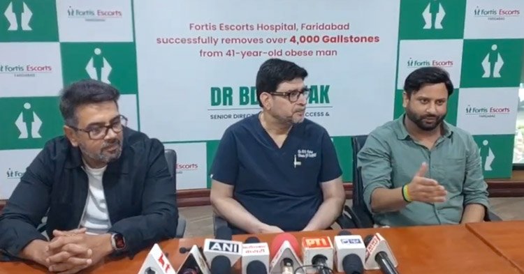 Fortis Escorts Faridabad Removes Over 4,000 Gallstones in Complex Laparoscopic Surgery