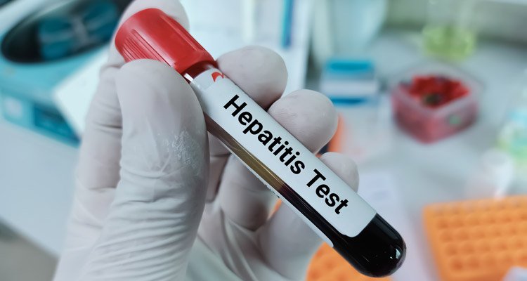 India’s 2030 Hepatitis Goal: Why Testing and Early Diagnosis Will Be Critical