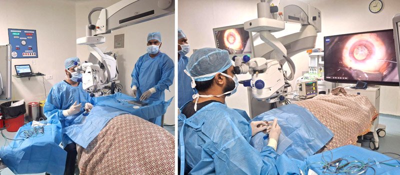 27-Year-Old Industrial Worker Regains Vision After Emergency Surgery for Metallic Foreign Body in Right Eye