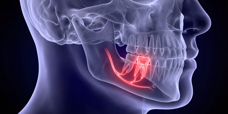 49-Year-Old Cancer Survivor Gets New Jaw with 3D-Designed Titanium Implant After Complex Post-Cancer Deformity