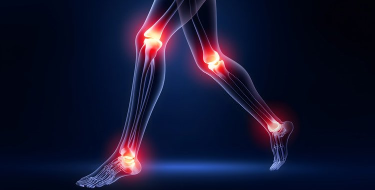 Arthritis Myths vs Facts: Does Joint Pain Always Mean Arthritis, and Can It Be Prevented?