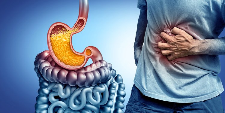 Late-Night Meals and Acid Reflux: How Long Before Bed Should You Stop Eating?