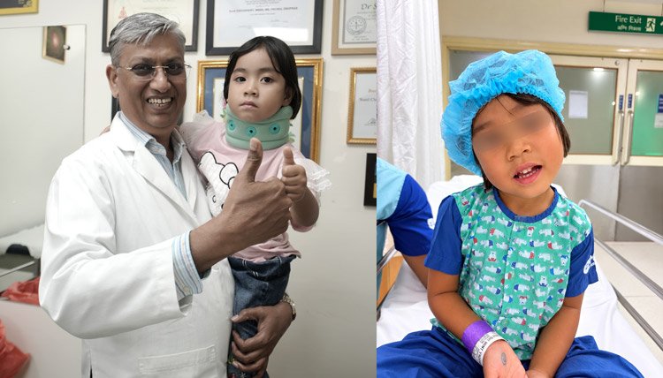 Doctors at Max Hospital, Saket, Correct Congenital Neck Deformity in Four-Year-Old Girl from Myanmar through Reconstructive Surgery