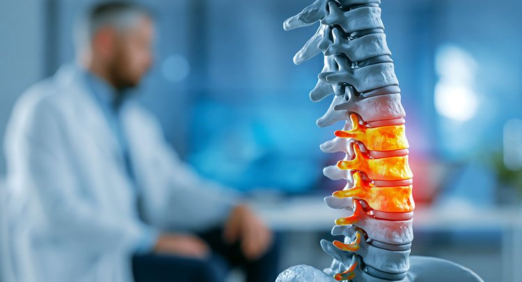 Sri Lankan Patient Regains Mobility at Iswarya Hospital, Chennai, After Complex Revision Spine Surgery Following Two Unsuccessful Spine Surgeries